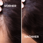 vorhernachher hair
